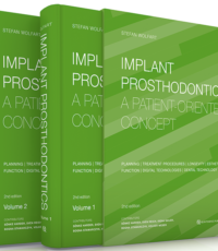 Implant Prosthodontics